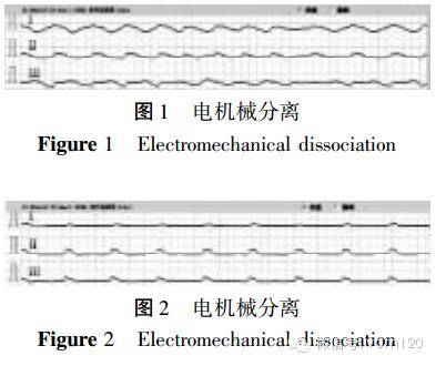 超全总结 | 心电图危急值识别