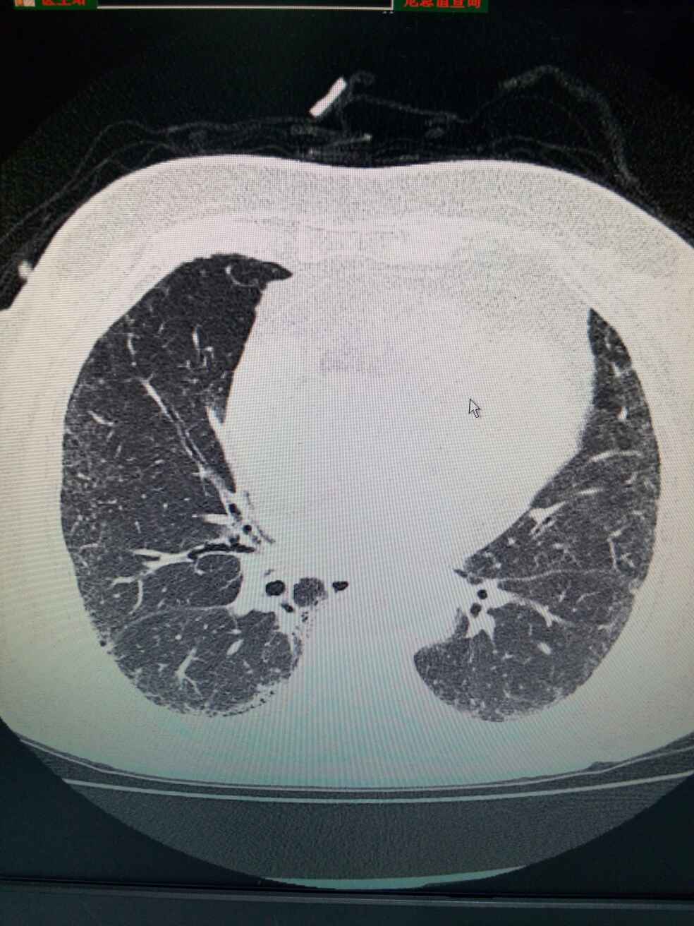 病例图片