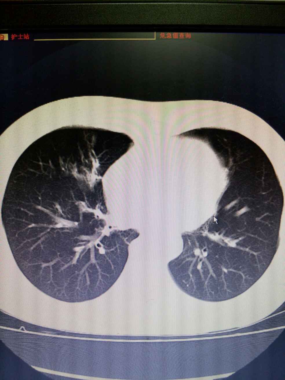 病例图片