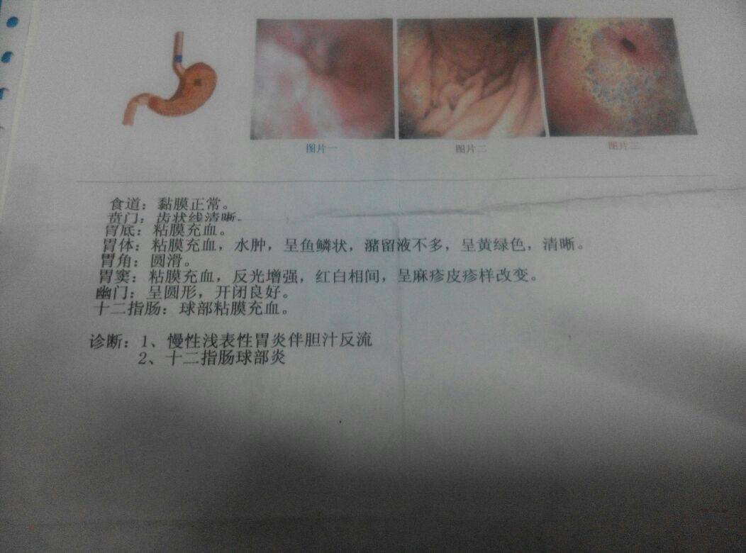 病例图片