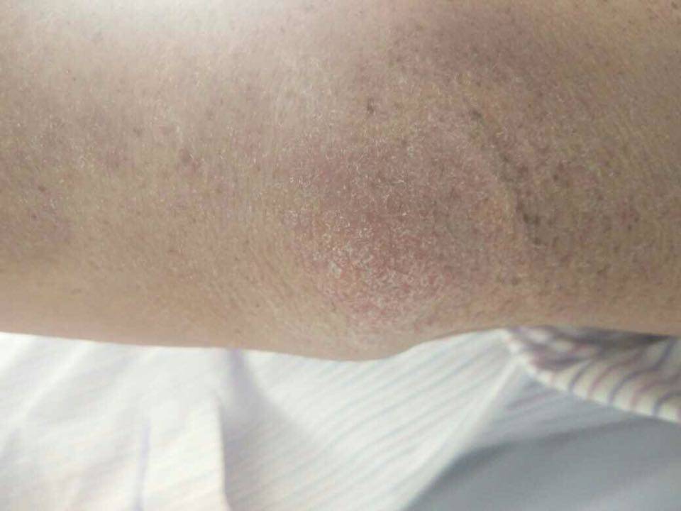 病例图片