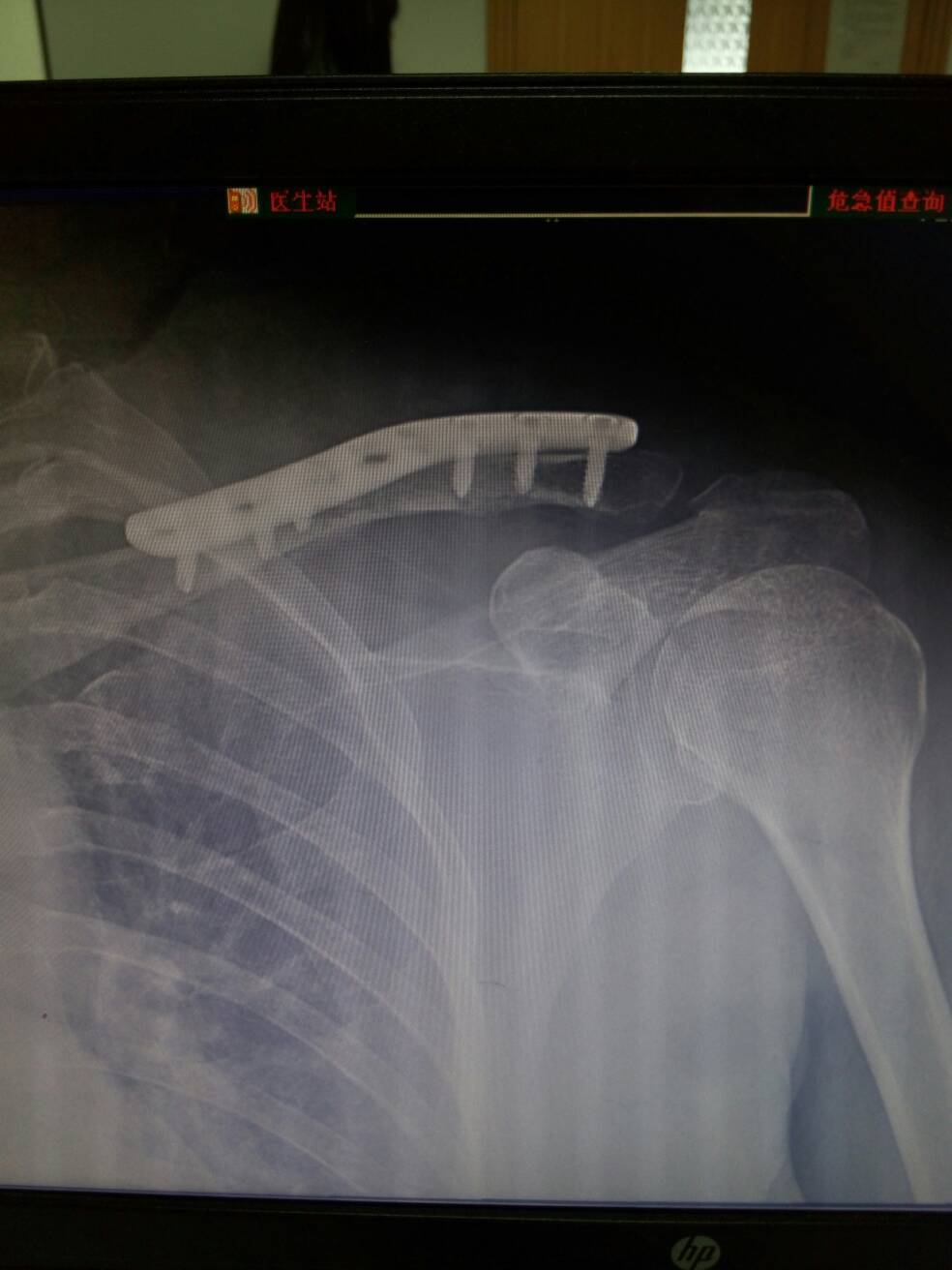 病例图片