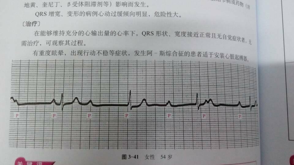 病例图片