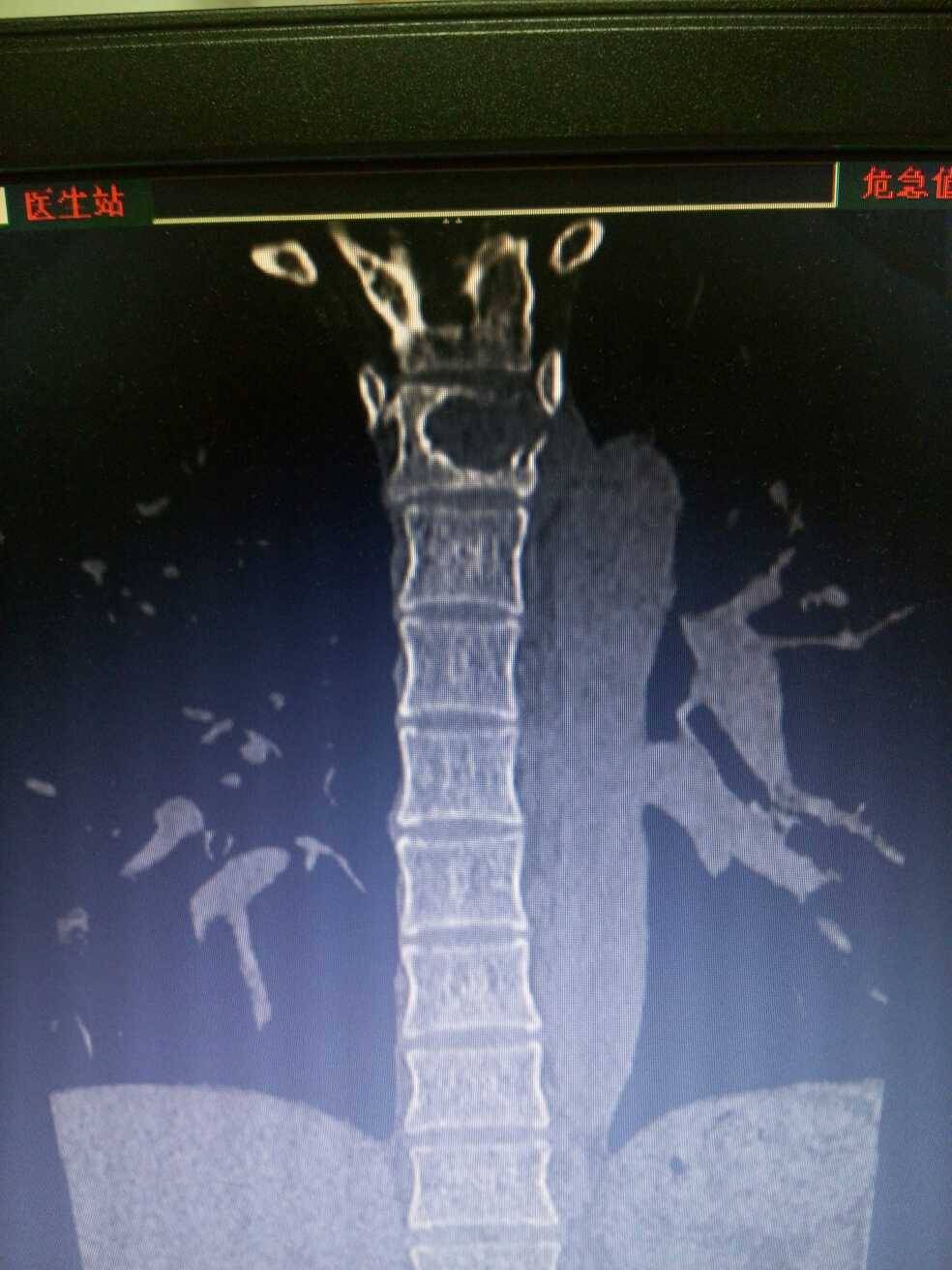 病例图片