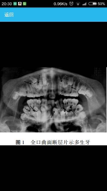 病例图片