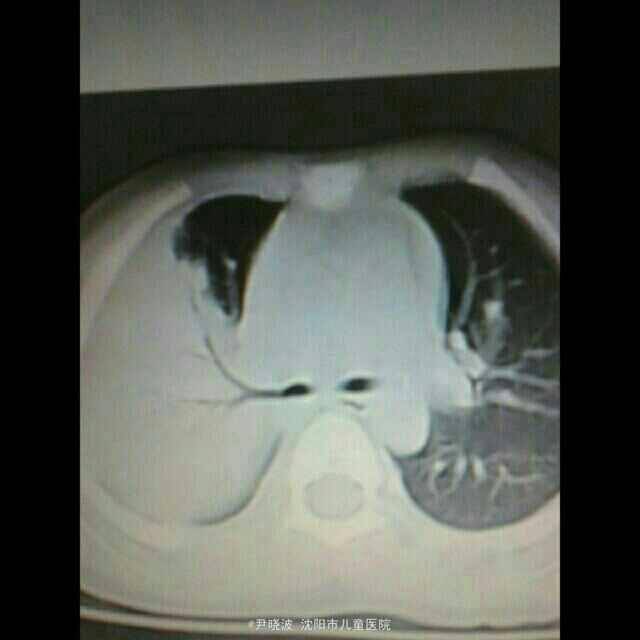 病例图片