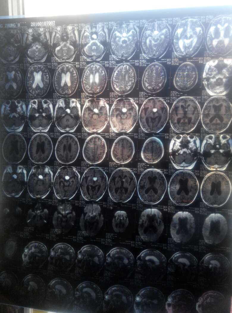 病例图片
