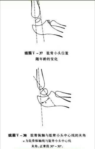 病例图片