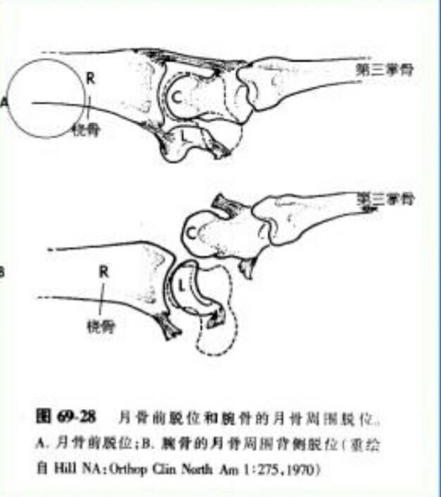 病例图片