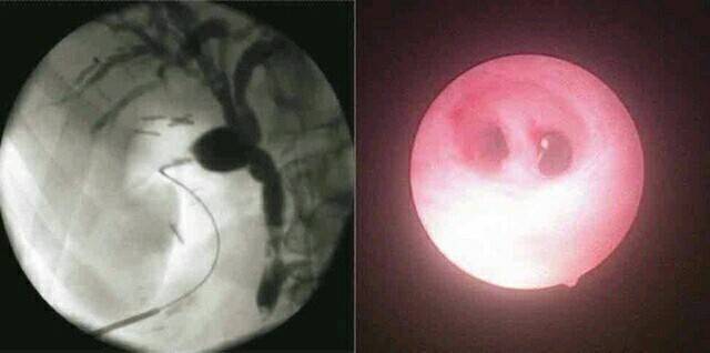 病例图片