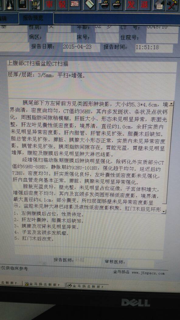 病例图片