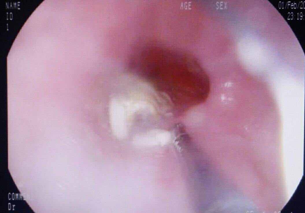 病例图片