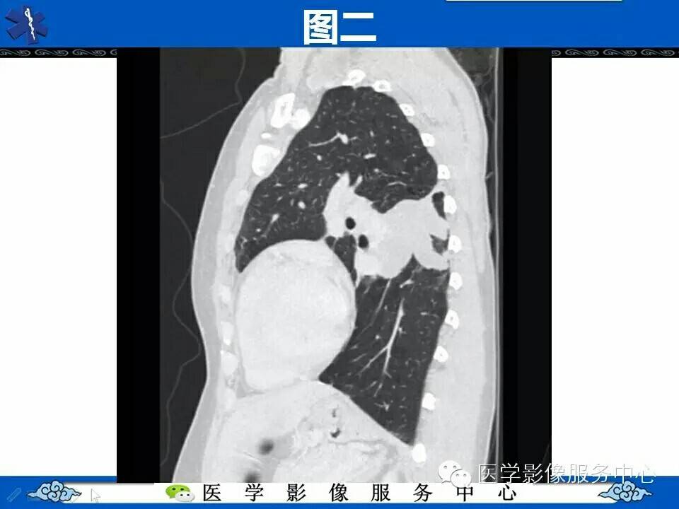 病例图片