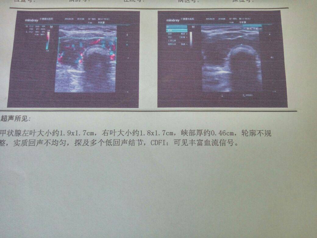 病例图片