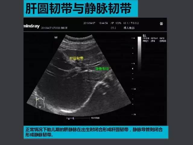 肝脏超声基础及分段分叶