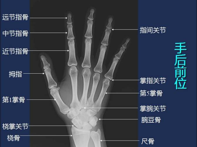 常规手-腕部x线影像解剖