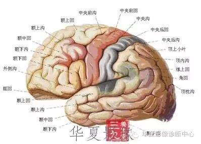 蛛网膜下腔出血的影像学表现