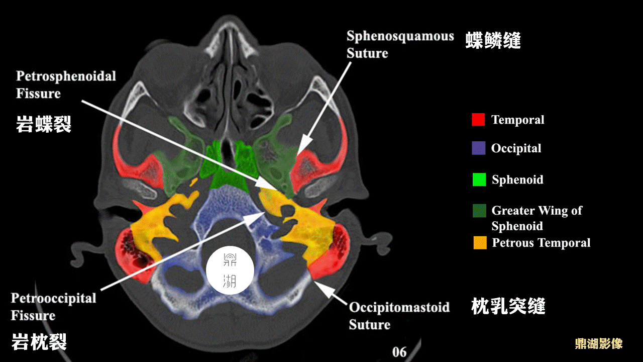 超精致颅底ct断层解剖