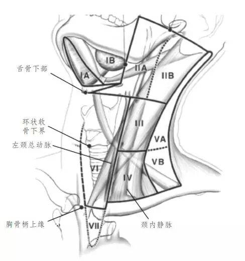[有图有真相]颈部淋巴结的分区解析