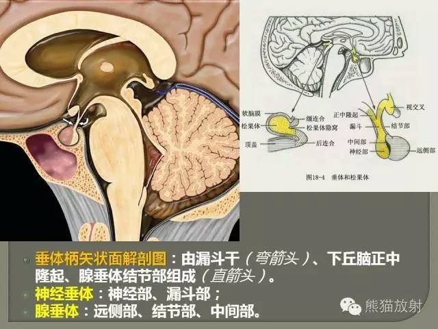 垂体柄解剖及常见病变