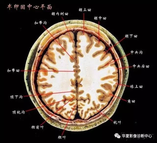 半卵圆中心与放射冠有什么区别