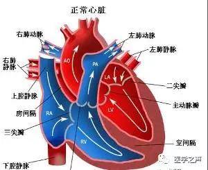 总结:心肌梗死后心脏破裂,一文打尽