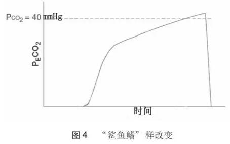 呼气末二氧化碳监测,为啥这么重要?