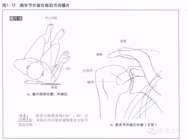 肩关节x线检查体位大全,你都了解吗?