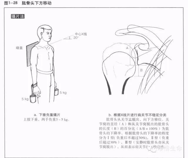 肩关节x线检查体位大全你都了解吗