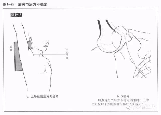 肩关节x线检查体位大全,你都了解吗?