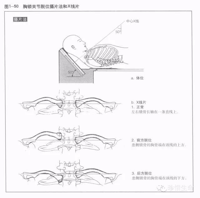 肩关节x线检查体位大全你都了解吗