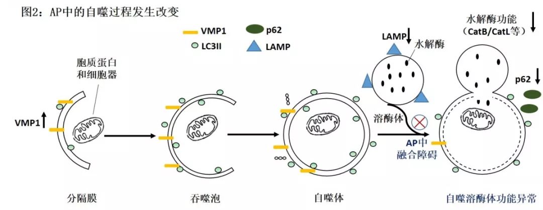 自噬与急性胰腺炎