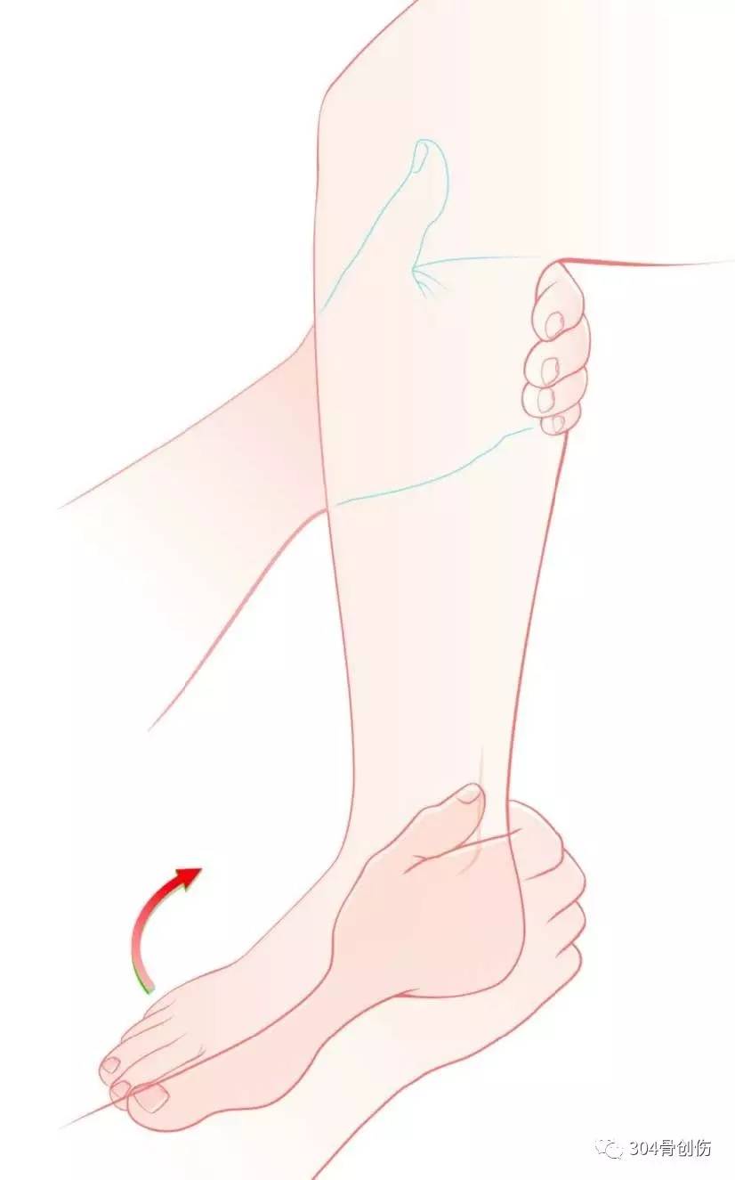 踝关节骨折(九)下胫腓联合2