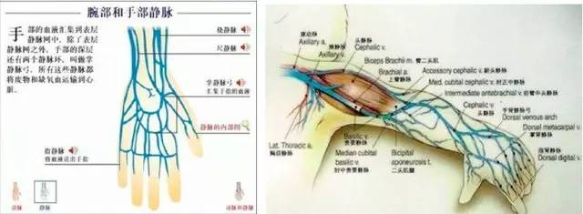 案例挑战!7 种常见且有难度的静脉穿刺