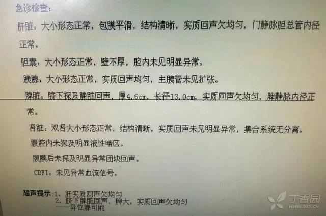 腹部彩超结果 提示: 脐下脾脏回声,脾大,实质回声欠均匀,异位脾可能.