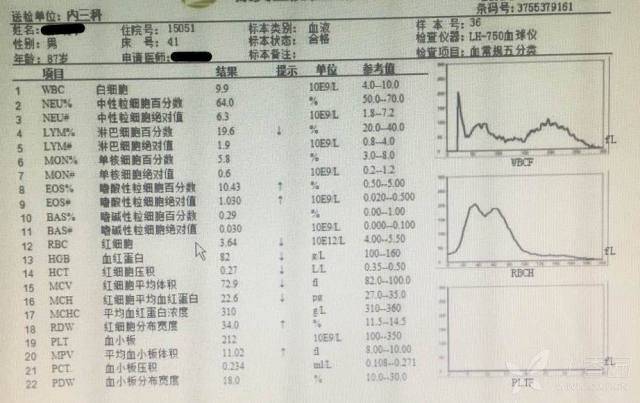 肝脏密度均匀增高,是血色素沉着症吗?