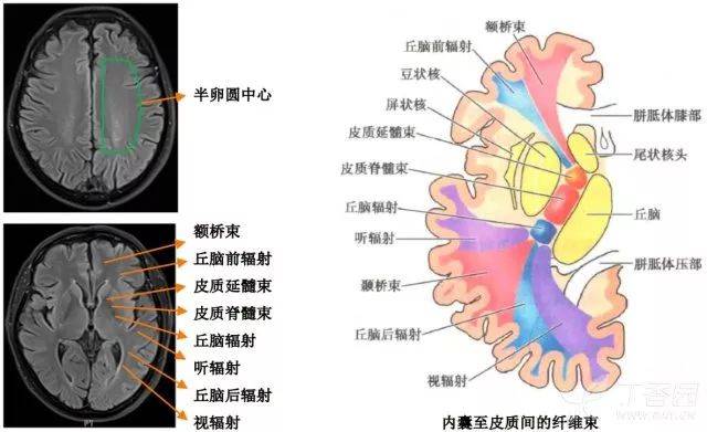 半卵圆中心和放射冠解剖