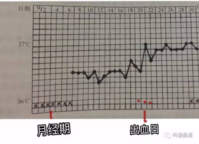 基础体温曲线没有异常,出血发生在两次月经中间,体温上升前后.