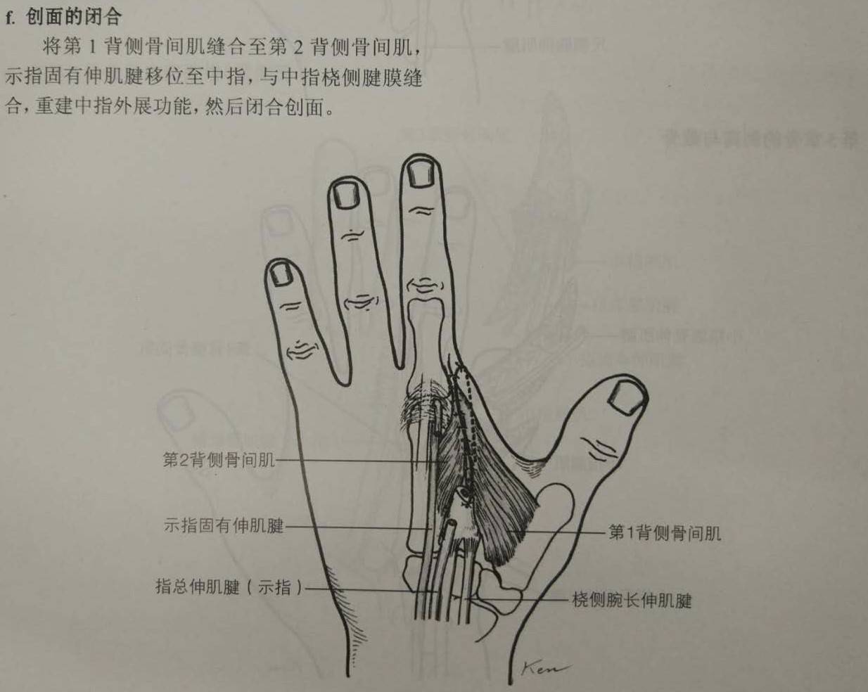 手的腱鞘 (掌面观)-基础医学-医学
